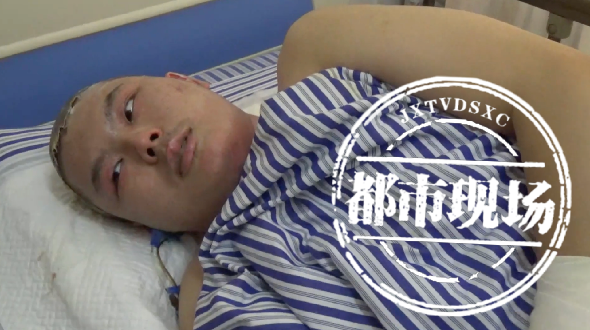 太揪心，凌晨时分一家三口重度烧伤！好温暖，他们期盼更多爱心！